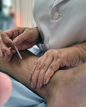 Descubra os benefícios da acupuntura: equilíbrio, alívio e bem-estar através de agulhas e energia.