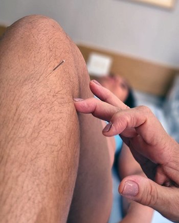 Existem várias formas para se localizar os pontos de acupuntura, pois muitos são os pontos de acupuntura que estão situados em locais anatomicamente demarcados, como próximo às inserções de músculos e tendões, em espaços nas articulações, proeminências ósseas, e em sulcos da pele.