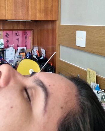 Descubra o poder transformador da acupuntura no alívio das dores e na busca por uma vida mais plena. 
Deixe a sabedoria milenar da medicina chinesa guiar você rumo ao bem-estar.